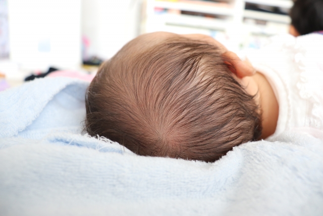 ヘルメット治療中の赤ちゃんのイメージ